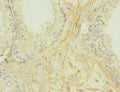 Secondary antibody only control: uses 1% BSA instead of primary antibody