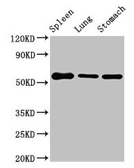 Western Blot
Positive WB detected in: Mouse spleen tissue, Mouse lung tissue, Mouse stomach tissue
All lanes: Glp1r antibody at 3µg/ml
Secondary
Goat polyclonal to rabbit IgG at 1/50000 dilution
Predicted band size: 54 kDa
Observed band size: 54 kDa