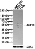 Western blot
All lanes: GLP1R antibody at 2µg/ml + 293T whole cell lysate
Secondary
Goat polyclonal to rabbit IgG at 1/10000 dilution
Predicted band size: 54 kDa
Observed band size: 54 kDa