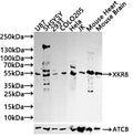 Western blot
All lanes: GLP1R antibody at 12µg/ml
Lane 1: Mouse heart tissue
Lane 2: 293T whole cell lysate
Secondary
Goat polyclonal to rabbit IgG at 1/10000 dilution
Predicted band size: 54 kDa
Observed band size: 54 kDa