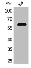 Western Blot analysis of L929 cells using IL-2Rβ Polyclonal Antibody