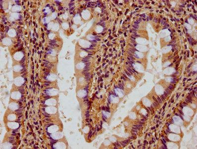 IHC image of CSB-PA009605LA01HU diluted at 1:500 and staining in paraffin-embedded human small intestine tissue performed on a Leica BondTM system. After dewaxing and hydration, antigen retrieval was mediated by high pressure in a citrate buffer (pH 6.0). Section was blocked with 10% normal goat serum 30min at RT. Then primary antibody (1% BSA) was incubated at 4&deg;C overnight. The primary is detected by a biotinylated secondary antibody and visualized using an HRP conjugated SP system.