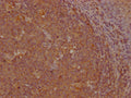 IHC image of CSB-PA009627LA01HU diluted at 1:200 and staining in paraffin-embedded human tonsil tissue performed on a Leica BondTM system. After dewaxing and hydration, antigen retrieval was mediated by high pressure in a citrate buffer (pH 6.0). Section was blocked with 10% normal goat serum 30min at RT. Then primary antibody (1% BSA) was incubated at 4°C overnight. The primary is detected by a Goat anti-rabbit IgG labeled by HRP and visualized using 0.05% DAB.