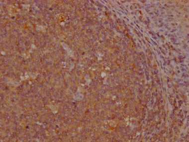 IHC image of CSB-PA009627LA01HU diluted at 1:200 and staining in paraffin-embedded human tonsil tissue performed on a Leica BondTM system. After dewaxing and hydration, antigen retrieval was mediated by high pressure in a citrate buffer (pH 6.0). Section was blocked with 10% normal goat serum 30min at RT. Then primary antibody (1% BSA) was incubated at 4°C overnight. The primary is detected by a Goat anti-rabbit IgG labeled by HRP and visualized using 0.05% DAB.