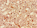 Immunohistochemistry of paraffin-embedded human brain tissue using CSB-PA009629LA01HU at dilution of 1:100