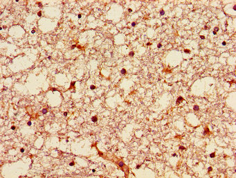 Immunohistochemistry of paraffin-embedded human brain tissue using CSB-PA009629LA01HU at dilution of 1:100
