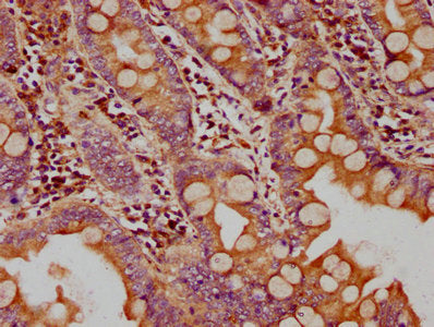 IHC image of CSB-PA009726LA01HU diluted at 1:400 and staining in paraffin-embedded human small intestine tissue performed on a Leica BondTM system. After dewaxing and hydration, antigen retrieval was mediated by high pressure in a citrate buffer (pH 6.0). Section was blocked with 10% normal goat serum 30min at RT. Then primary antibody (1% BSA) was incubated at 4°C overnight. The primary is detected by a biotinylated secondary antibody and visualized using an HRP conjugated SP system.