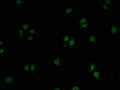 Immunofluorescence staining of A549 cells with CSB-PA009856LA01HU-IF at 1:100, counter-stained with DAPI. The cells were fixed in 4% formaldehyde and blocked in 10% normal Goat Serum. The cells were then incubated with the antibody overnight at 4°C. The secondary antibody was Alexa Fluor 488-congugated AffiniPure Goat Anti-Rabbit IgG(H+L).