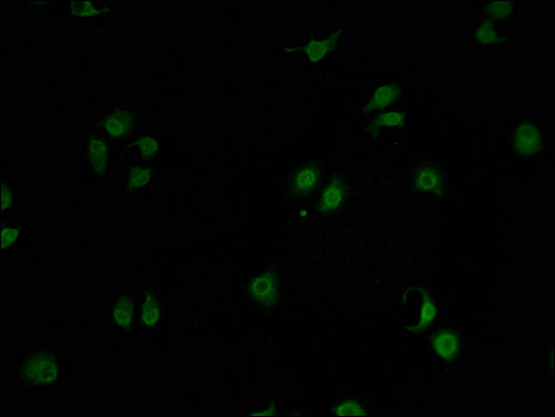 Immunofluorescence staining of A549 cells with CSB-PA009856LA01HU-IF at 1:100, counter-stained with DAPI. The cells were fixed in 4% formaldehyde and blocked in 10% normal Goat Serum. The cells were then incubated with the antibody overnight at 4°C. The secondary antibody was Alexa Fluor 488-congugated AffiniPure Goat Anti-Rabbit IgG(H+L).
