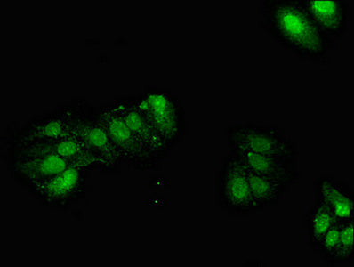 Immunofluorescent analysis of HepG2 cells using CSB-PA009867LA01HU at dilution of 1:100 and Alexa Fluor 488-congugated AffiniPure Goat Anti-Rabbit IgG(H+L)