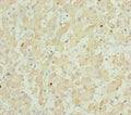 Immunohistochemistry of paraffin-embedded human liver tissue using CSB-PA009870DSR1HU at dilution of 1:100