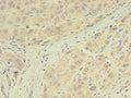 GPX7 Antibody, FITC conjugated – Figure 1 of 1