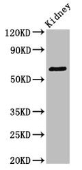 Western Blot
Positive WB detected in: Mouse kidney tissue
All lanes: GRK5 antibody at 3.4ug/ml
Secondary
Goat polyclonal to rabbit IgG at 1/50000 dilution
Predicted band size: 68 kDa
Observed band size: 68 kDa
