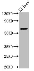 Western Blot
Positive WB detected in: Mouse kidney tissue
All lanes: GRK5 antibody at 3.4ug/ml
Secondary
Goat polyclonal to rabbit IgG at 1/50000 dilution
Predicted band size: 68 kDa
Observed band size: 68 kDa