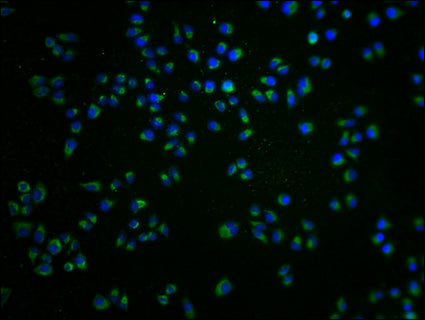 Immunofluorescence staining of Hela cells with CSB-PA009929LA01HU at 1:100, counter-stained with DAPI. The cells were fixed in 4% formaldehyde and blocked in 10% normal Goat Serum. The cells were then incubated with the antibody overnight at 4°C. The secondary antibody was Alexa Fluor 488-congugated AffiniPure Goat Anti-Rabbit IgG(H+L).
