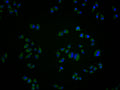 Immunofluorescence staining of Hela cells with CSB-PA009929LA11HU at 1:100, counter-stained with DAPI. The cells were fixed in 4% formaldehyde and blocked in 10% normal Goat Serum. The cells were then incubated with the antibody overnight at 4°C. The secondary antibody was Alexa Fluor 488-congugated AffiniPure Goat Anti-Rabbit IgG(H+L).