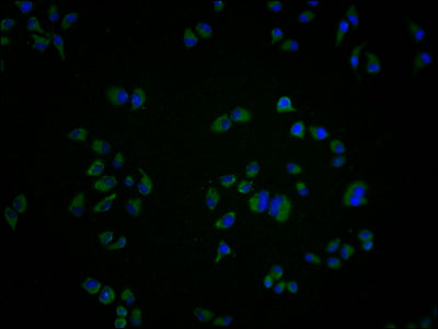 Immunofluorescence staining of Hela cells with CSB-PA009929LA11HU at 1:100, counter-stained with DAPI. The cells were fixed in 4% formaldehyde and blocked in 10% normal Goat Serum. The cells were then incubated with the antibody overnight at 4°C. The secondary antibody was Alexa Fluor 488-congugated AffiniPure Goat Anti-Rabbit IgG(H+L).