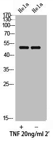 Western Blot analysis of HELA cells using Phospho-Smad3 (T179) Polyclonal Antibody