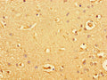 Immunohistochemistry of paraffin-embedded human brain tissue using CSB-PA010053LA01HU at dilution of 1:100