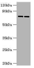 Western blot All lanes: AGUSB antibody at 2ug/ml Lane 1: HL60 whole cell lysate Lane 2: HepG2 whole cell lysate Secondary Goat polyclonal to rabbit IgG at 1/10000 dilution Predicted band size: 75, 70, 59 kDa Observed band size: 75 kDa