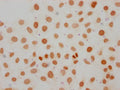 Immunocytochemistry analysis of CSB-PA010087OA107me1HU diluted at 1:50 and staining in Hela cells performed on a Leica BondTM system. The cells were fixed in 4% formaldehyde, permeabilized using 0.2% Triton X-100 and blocked with 10% normal goat serum 30min at RT. Then primary antibody (1% BSA) was incubated at 4°C overnight. The primary is detected by a biotinylated secondary antibody and visualized using an HRP conjugated SP system.