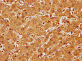 IHC image of CSB-PA010087OA107nme1HU diluted at 1:10 and staining in paraffin-embedded human liver tissue performed on a Leica BondTM system. After dewaxing and hydration, antigen retrieval was mediated by high pressure in a citrate buffer (pH 6.0). Section was blocked with 10% normal goat serum 30min at RT. Then primary antibody (1% BSA) was incubated at 4°C overnight. The primary is detected by a biotinylated secondary antibody and visualized using an HRP conjugated SP system.