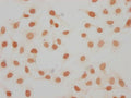 Immunocytochemistry analysis of CSB-PA010087OA11me1HU diluted at 1:15 and staining in Hela cells performed on a Leica BondTM system. The cells were fixed in 4% formaldehyde, permeabilized using 0.2% Triton X-100 and blocked with 10% normal goat serum 30min at RT. Then primary antibody (1% BSA) was incubated at 4°C overnight. The primary is detected by a biotinylated secondary antibody and visualized using an HRP conjugated SP system.