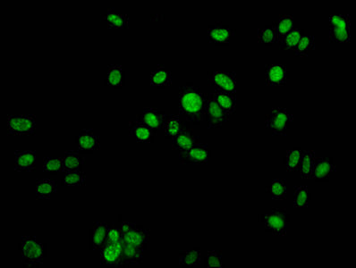 Immunofluorescence staining of HepG2 cells with CSB-PA010097OA142phHU at 1:25, counter-stained with DAPI. The cells were fixed in 4% formaldehyde, permeabilized using 0.2% Triton X-100 and blocked in 10% normal Goat Serum. The cells were then incubated with the antibody overnight at 4&deg;C. The secondary antibody was Alexa Fluor 488-congugated AffiniPure Goat Anti-Rabbit IgG(H+L).