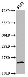 Western Blot
Positive WB detected in: K562 whole cell lysate (treated by 30mM sodium butyrate for 4h)
All lanes: H2AFZ antibody at 1.06µg/ml
Secondary
Goat polyclonal to rabbit IgG at 1/50000 dilution
Predicted band size: 14 kDa
Observed band size: 14 kDa