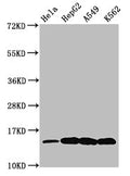 Western Blot
Positive WB detected in: Hela whole cell lysate, HepG2 whole cell lysate, A549 whole cell lysate, K562 whole cell lysate (All treated by 30mM sodium butyrate for 4h)
All lanes: H2AFZ antibody at 0.48µg/ml
Secondary
Goat polyclonal to rabbit IgG at 1/50000 dilution
Predicted band size: 14 kDa
Observed band size: 14 kDa
