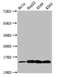 Western Blot
Positive WB detected in: Hela whole cell lysate, HepG2 whole cell lysate, A549 whole cell lysate, K562 whole cell lysate (All treated by 30mM sodium butyrate for 4h)
All lanes: H2AFZ antibody at 0.48µg/ml
Secondary
Goat polyclonal to rabbit IgG at 1/50000 dilution
Predicted band size: 14 kDa
Observed band size: 14 kDa