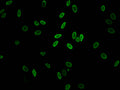 Immunofluorescent analysis of Hela cells (sodium butyrate, 30 mM, 4h) using CSB-PA010100PA11acHU at dilution of 1:100 and Alexa Fluor 488-congugated AffiniPure Goat Anti-Rabbit IgG(H+L)