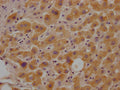 IHC image of CSB-PA010111LA01HU diluted at 1:100 and staining in paraffin-embedded human liver tissue performed on a Leica BondTM system. After dewaxing and hydration, antigen retrieval was mediated by high pressure in a citrate buffer (pH 6.0). Section was blocked with 10% normal goat serum 30min at RT. Then primary antibody (1% BSA) was incubated at 4°C overnight. The primary is detected by a Goat anti-rabbit polymer IgG labeled by HRP and visualized using 0.05% DAB.