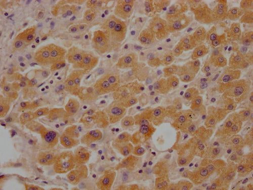 IHC image of CSB-PA010111LA01HU diluted at 1:100 and staining in paraffin-embedded human liver tissue performed on a Leica BondTM system. After dewaxing and hydration, antigen retrieval was mediated by high pressure in a citrate buffer (pH 6.0). Section was blocked with 10% normal goat serum 30min at RT. Then primary antibody (1% BSA) was incubated at 4°C overnight. The primary is detected by a Goat anti-rabbit polymer IgG labeled by HRP and visualized using 0.05% DAB.