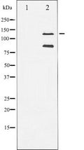 Western blot analysis of extracts from A549 cells,The lane on the left is treated with the antigen-specific peptide.