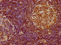 IHC image of CSB-PA010335OA01HU diluted at 1:100 and staining in paraffin-embedded human lymph node tissue performed on a Leica BondTM system. After dewaxing and hydration, antigen retrieval was mediated by high pressure in a citrate buffer (pH 6.0). Section was blocked with 10% normal goat serum 30min at RT. Then primary antibody (1% BSA) was incubated at 4°C overnight. The primary is detected by a biotinylated secondary antibody and visualized using an HRP conjugated SP system.
