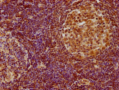 IHC image of CSB-PA010335OA01HU diluted at 1:100 and staining in paraffin-embedded human lymph node tissue performed on a Leica BondTM system. After dewaxing and hydration, antigen retrieval was mediated by high pressure in a citrate buffer (pH 6.0). Section was blocked with 10% normal goat serum 30min at RT. Then primary antibody (1% BSA) was incubated at 4°C overnight. The primary is detected by a biotinylated secondary antibody and visualized using an HRP conjugated SP system.