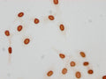 Immunocytochemistry analysis of CSB-PA010376OA21acHU diluted at 1:25 and staining in Hela cells(treated with 30mM sodium butyrate for 4h) performed on a Leica BondTM system. The cells were fixed in 4% formaldehyde, permeabilized using 0.2% Triton X-100 and blocked with 10% normal goat serum 30min at RT. Then primary antibody (1% BSA) was incubated at 4°C overnight. The primary is detected by a biotinylated secondary antibody and visualized using an HRP conjugated SP system.