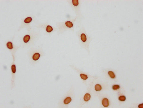 Immunocytochemistry analysis of CSB-PA010376OA21acHU diluted at 1:25 and staining in Hela cells(treated with 30mM sodium butyrate for 4h) performed on a Leica BondTM system. The cells were fixed in 4% formaldehyde, permeabilized using 0.2% Triton X-100 and blocked with 10% normal goat serum 30min at RT. Then primary antibody (1% BSA) was incubated at 4°C overnight. The primary is detected by a biotinylated secondary antibody and visualized using an HRP conjugated SP system.