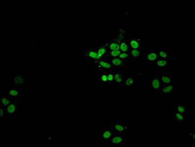 Immunofluorescent analysis of HepG2 cells (sodium butyrate, 30 mM, 4h) using CSB-PA010376PA21acHU at dilution of 1:100 and Alexa Fluor 488-congugated AffiniPure Goat Anti-Rabbit IgG(H+L)