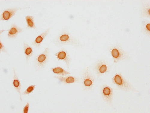 Immunocytochemistry analysis of CSB-PA010377OA137phHU diluted at 1:10 and staining in Hela cells(treated with 50nM Calyculin A for 30min) performed on a Leica BondTM system. The cells were fixed in 4% formaldehyde, permeabilized using 0.2% Triton X-100 and blocked with 10% normal goat serum 30min at RT. Then primary antibody (1% BSA) was incubated at 4°C overnight. The primary is detected by a biotinylated secondary antibody and visualized using an HRP conjugated SP system.