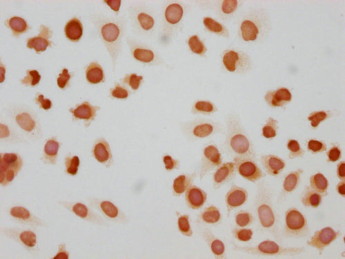 Immunocytochemistry analysis of CSB-PA010377OA172phHU diluted at 1:10 and staining in Hela cells(treated with 50nM Calyculin A for 30min) performed on a Leica BondTM system. The cells were fixed in 4% formaldehyde, permeabilized using 0.2% Triton X-100 and blocked with 10% normal goat serum 30min at RT. Then primary antibody (1% BSA) was incubated at 4°C overnight. The primary is detected by a biotinylated secondary antibody and visualized using an HRP conjugated SP system.