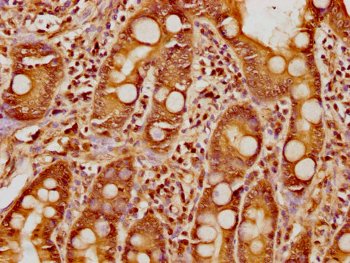 IHC image of CSB-PA010377OA17nphHU diluted at 1:8 and staining in paraffin-embedded human small intestine tissue performed on a Leica BondTM system. After dewaxing and hydration, antigen retrieval was mediated by high pressure in a citrate buffer (pH 6.0). Section was blocked with 10% normal goat serum 30min at RT. Then primary antibody (1% BSA) was incubated at 4°C overnight. The primary is detected by a biotinylated secondary antibody and visualized using an HRP conjugated SP system.