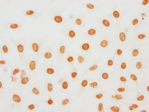 Immunocytochemistry analysis of CSB-PA010377OA188phHU diluted at 1:20 and staining in Hela cells(treated with 50nM Calyculin A for 30min) performed on a Leica BondTM system. The cells were fixed in 4% formaldehyde, permeabilized using 0.2% Triton X-100 and blocked with 10% normal goat serum 30min at RT. Then primary antibody (1% BSA) was incubated at 4°C overnight. The primary is detected by a biotinylated secondary antibody and visualized using an HRP conjugated SP system.