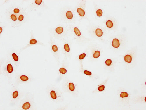Immunocytochemistry analysis of CSB-PA010377OA48acHU diluted at 1:15 and staining in Hela cells(treated with 30mM sodium butyrate for 4h) performed on a Leica BondTM system. The cells were fixed in 4% formaldehyde, permeabilized using 0.2% Triton X-100 and blocked with 10% normal goat serum 30min at RT. Then primary antibody (1% BSA) was incubated at 4°C overnight. The primary is detected by a biotinylated secondary antibody and visualized using an HRP conjugated SP system.