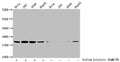 Western Blot
Detected samples: Hela whole cell lysate, 293 whole cell lysate, A549 whole cell lysate, HepG2 whole cell lysate; Untreated (-) or treated (+) with 30mM sodium butyrate for 4h
All lanes: HIST1H1C antibody at 3.5µg/ml
Secondary
Goat polyclonal to rabbit IgG at 1/50000 dilution
Predicted band size: 22 kDa
Observed band size: 22 kDa