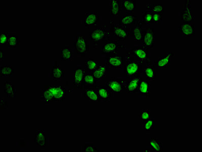 Immunofluorescence staining of Hela cells (treated with 30mM sodium butyrate for 4h) with CSB-PA010378OA135hibHU at 1:25, counter-stained with DAPI. The cells were fixed in 4% formaldehyde, permeabilized using 0.2% Triton X-100 and blocked in 10% normal Goat Serum. The cells were then incubated with the antibody overnight at 4&deg;C. The secondary antibody was Alexa Fluor 488-congugated AffiniPure Goat Anti-Rabbit IgG(H+L).