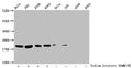 Western Blot
Detected samples: Hela whole cell lysate, 293 whole cell lysate, A549 whole cell lysate, K562 whole cell lysate; Untreated (-) or treated (+) with 30mM sodium butyrate for 4h
All lanes: HIST1H1C antibody at 1:100
Secondary
Goat polyclonal to rabbit IgG at 1/50000 dilution
Predicted band size: 22 kDa
Observed band size: 22 kDa