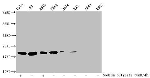 Western Blot
Detected samples: Hela whole cell lysate, 293 whole cell lysate, A549 whole cell lysate, K562 whole cell lysate; Untreated (-) or treated (+) with 30mM sodium butyrate for 4h
All lanes: HIST1H1C antibody at 1:100
Secondary
Goat polyclonal to rabbit IgG at 1/50000 dilution
Predicted band size: 22 kDa
Observed band size: 22 kDa
