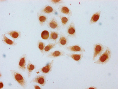 Immunocytochemistry analysis of CSB-PA010378OA22hibHU diluted at 1:5 and staining in Hela cells (treated with 30mM sodium butyrate for 4h) performed on a Leica BondTM system. The cells were fixed in 4% formaldehyde, permeabilized using 0.2% Triton X-100 and blocked with 10% normal goat serum 30min at RT. Then primary antibody (1% BSA) was incubated at 4&deg;C overnight. The primary is detected by a biotinylated secondary antibody and visualized using an HRP conjugated SP system.